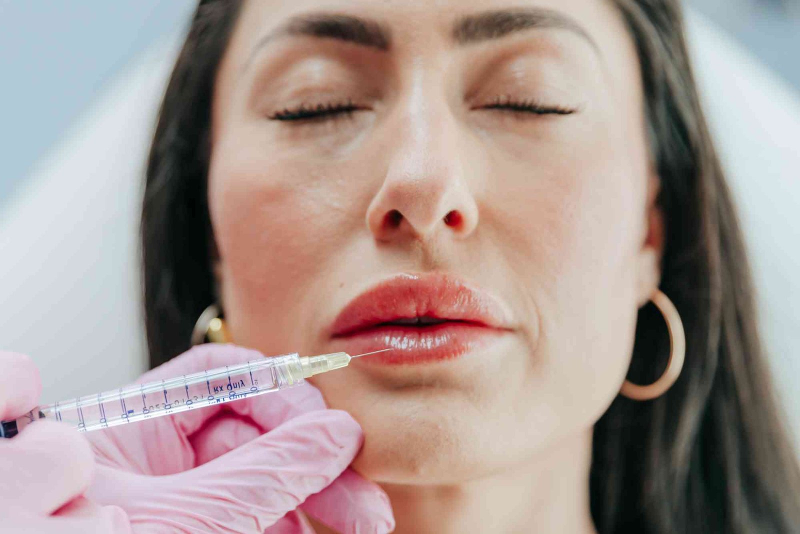 Can You Vape After Lip Fillers UK simple answers and practical tips